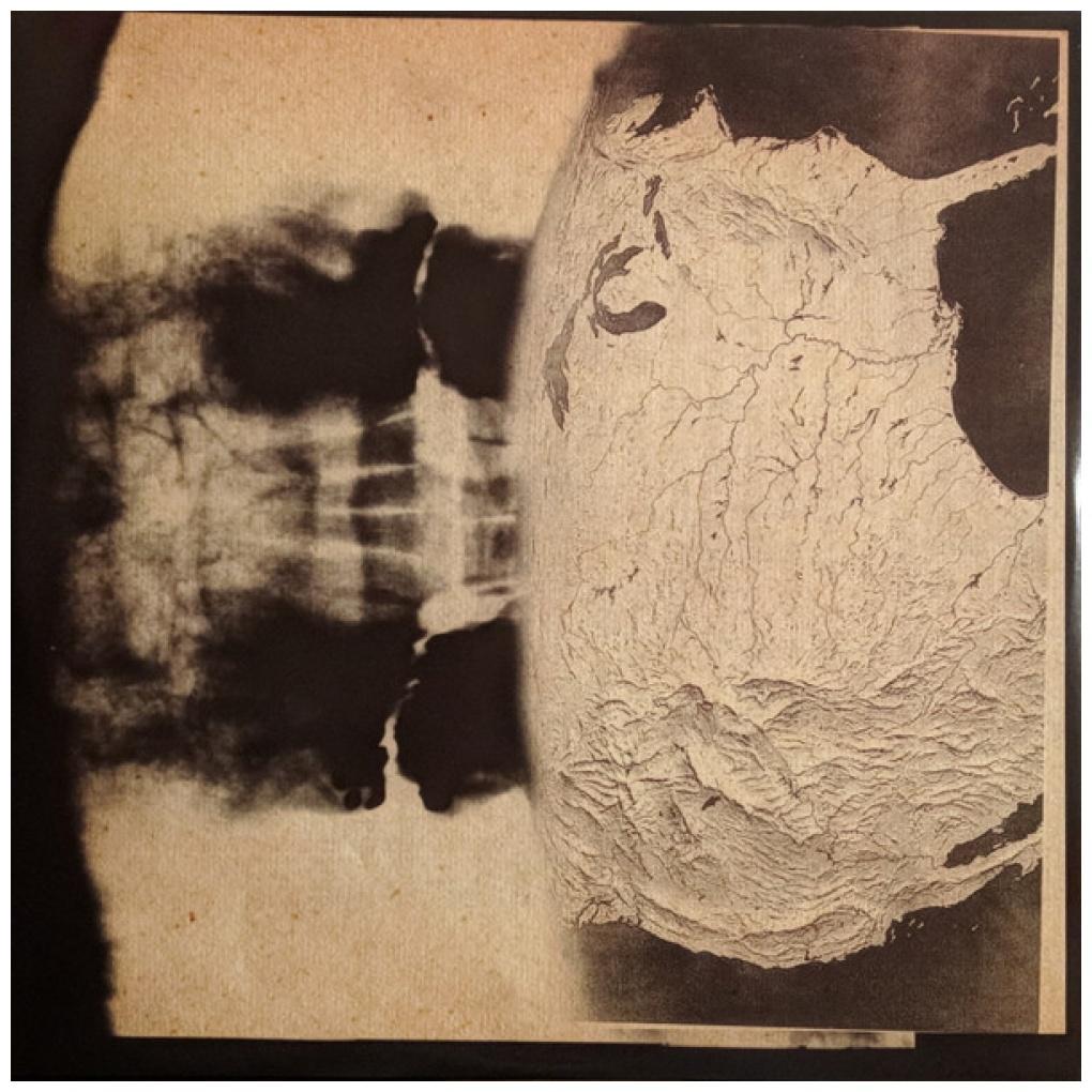 RADIOHEAD - AMNESIAC | VINILO